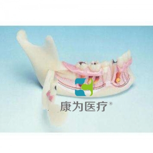 “康為醫療”下頜骨組織模型